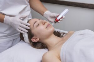 Mujer realizándose una sesión de tratamiento facial dermapen, complemento ideal para la mesoterapia facial