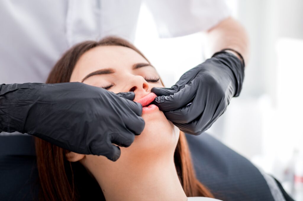 Masaje tras relleno de labios con ácido hialurónico