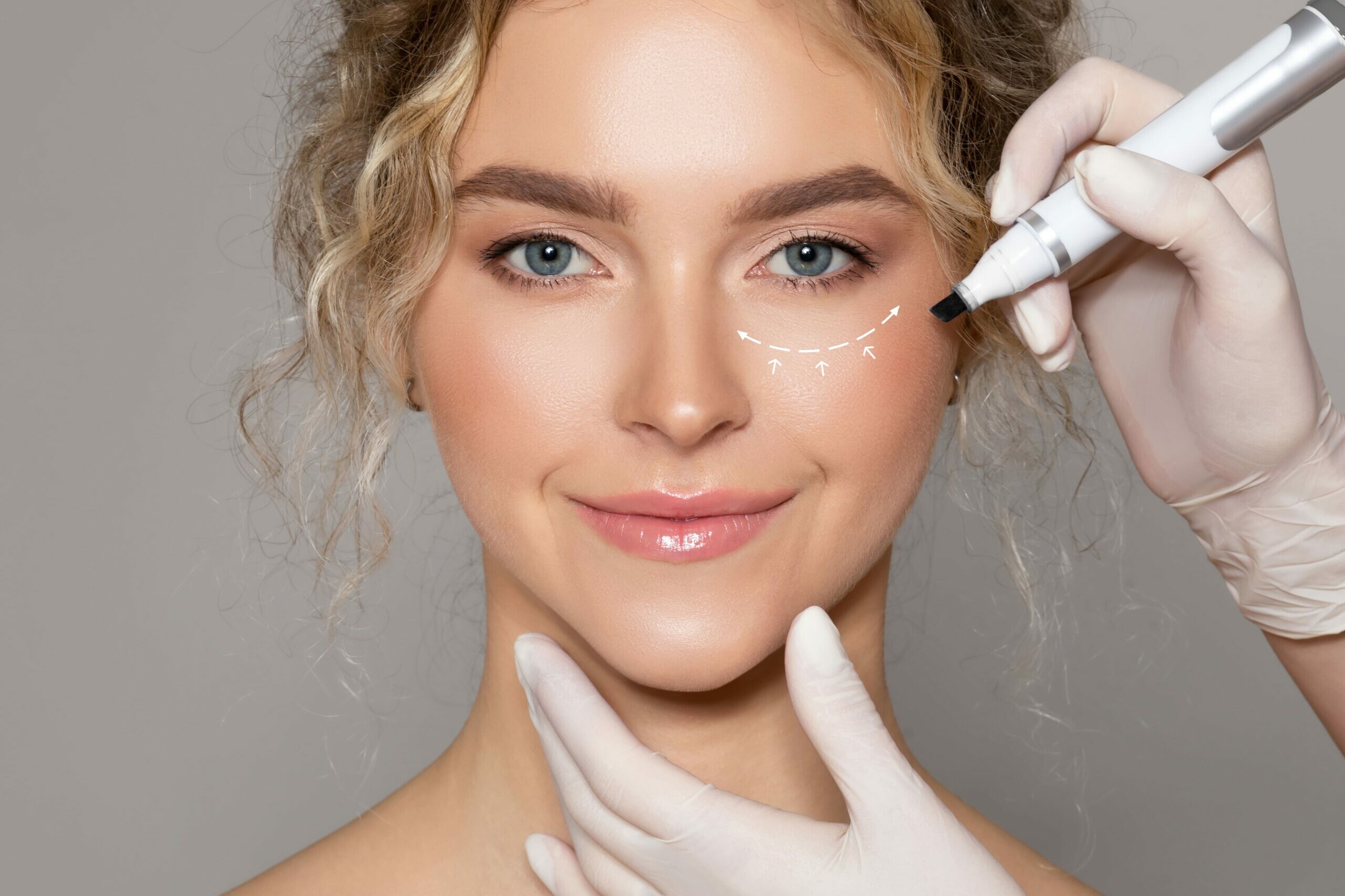Mujer durante tratamiento de ojeras
