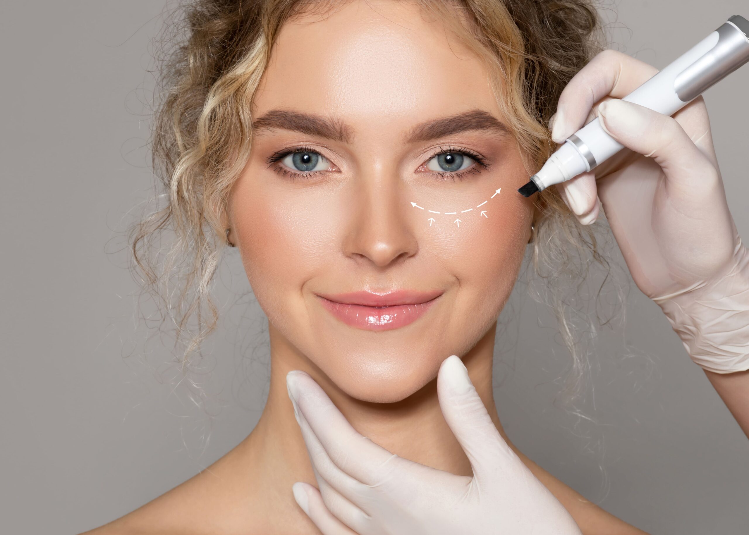 Mujer durante tratamiento de ojeras
